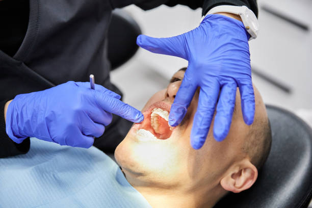 Best Lost Filling or Crown Replacement in Wilton, CA